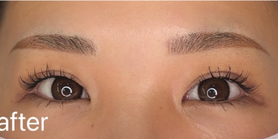 After