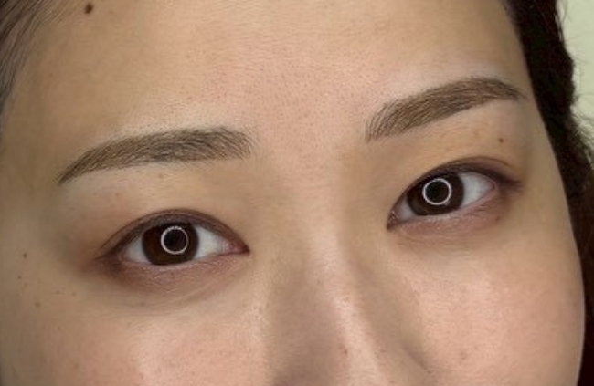 After