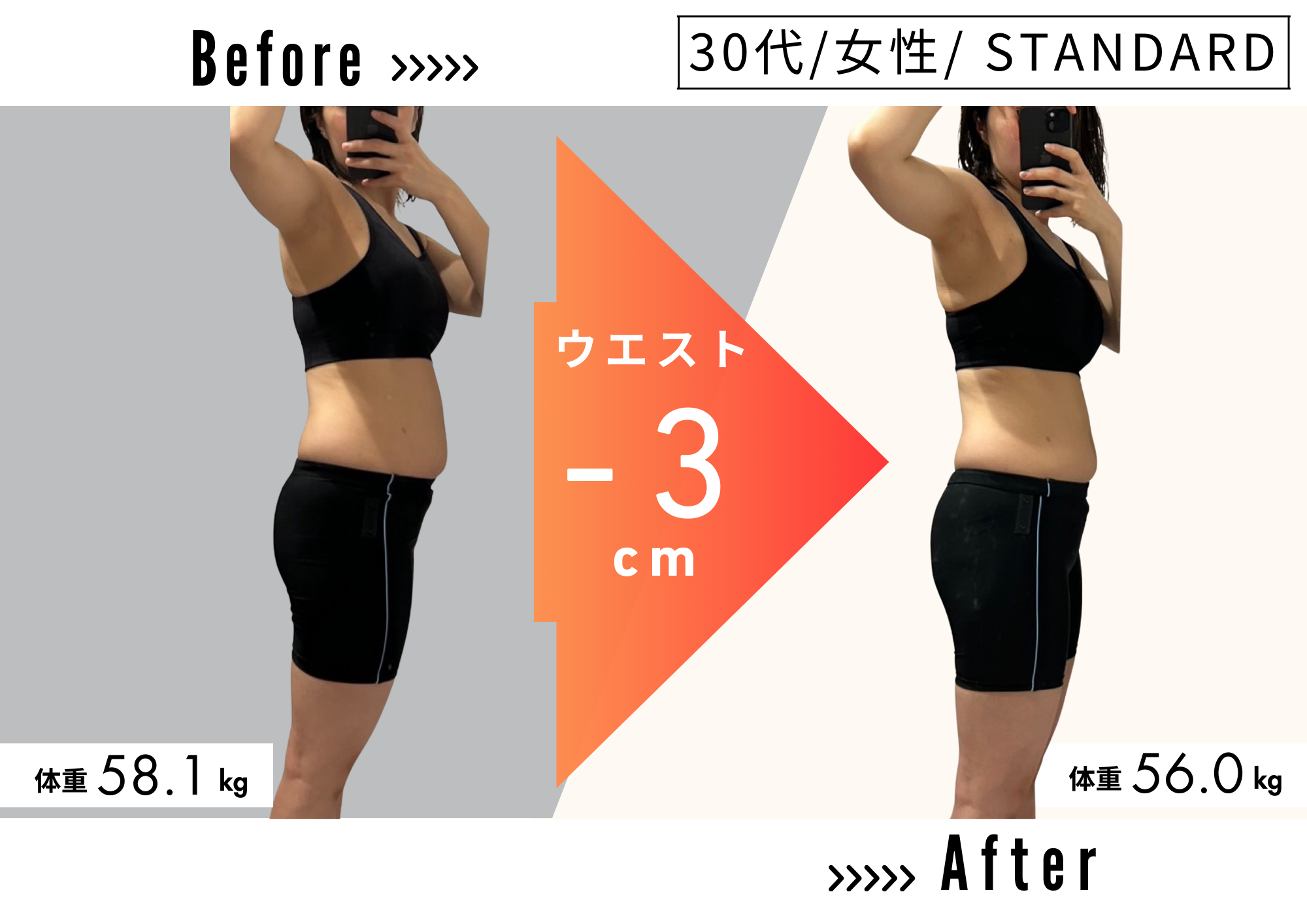 30代 女性 ／ STANDARDコースのビフォーアフター