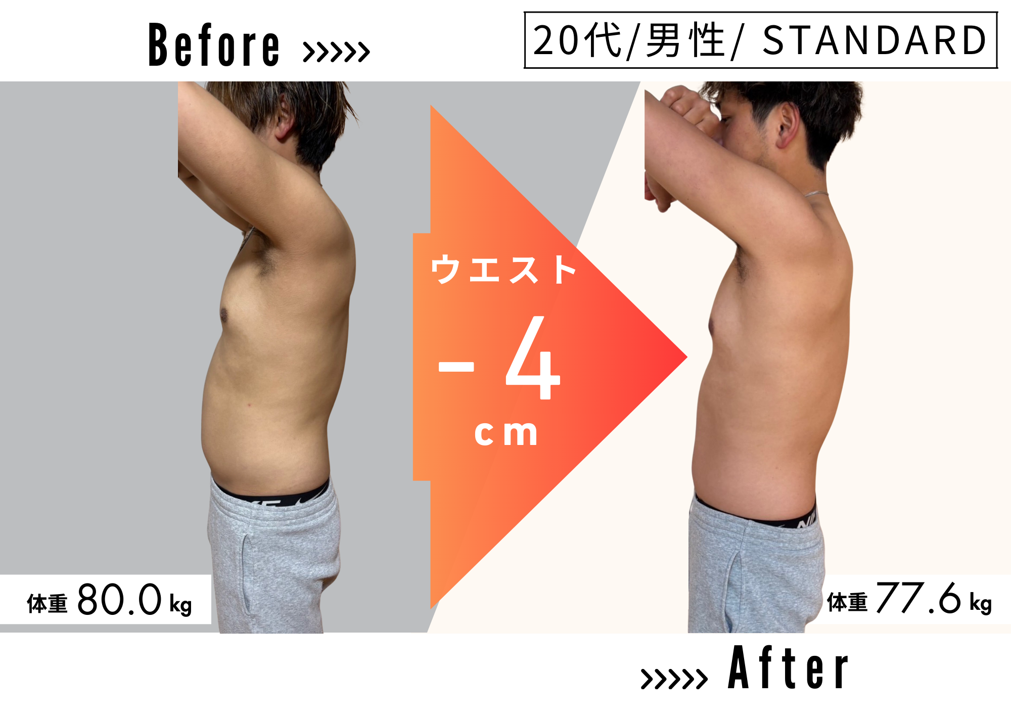 20代 男性 ／ STANDARDコースのビフォーアフター