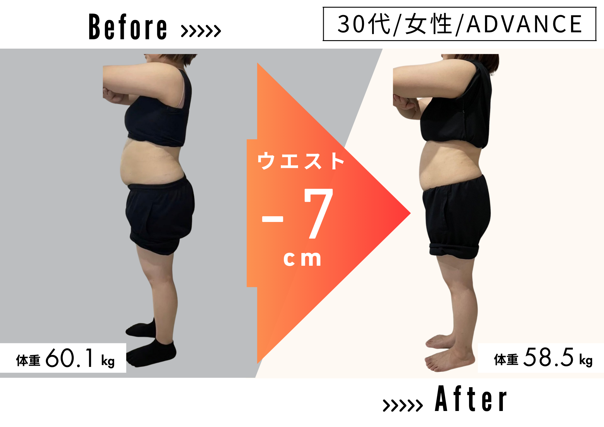 30代 女性 ／ ADVANCEコースのビフォーアフター