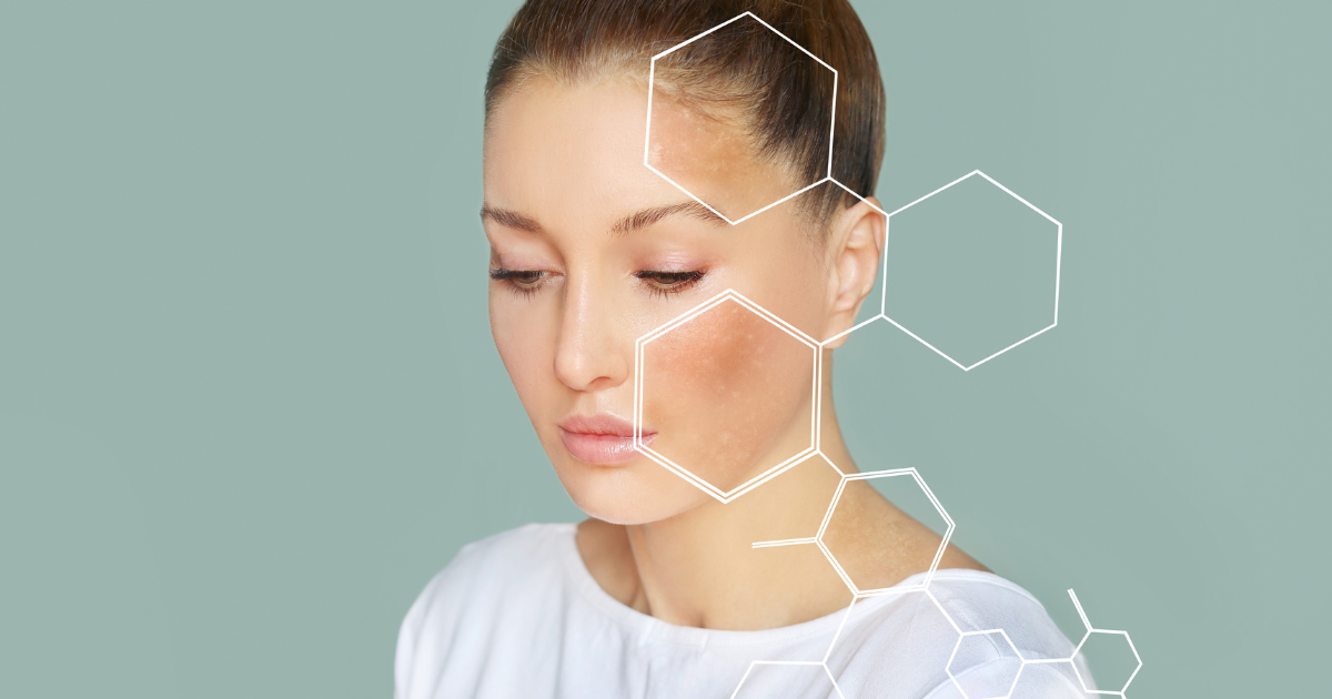 抗糖化とは？糖化を改善する食べ物やお茶について解説