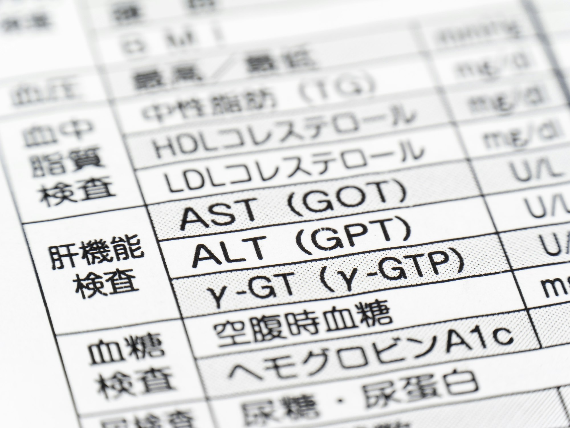 肝機能検査に関連するAST（GOT）、ALT（GPT）γ-GTP