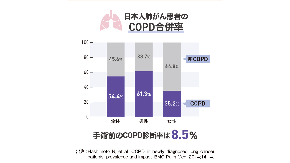 日本人肺がん患者のCOPD合併率