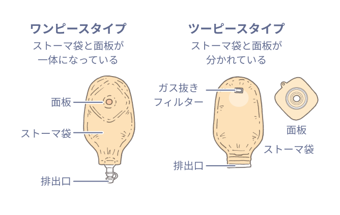 コレクション ストーマ パウチ 種類 ワンピース