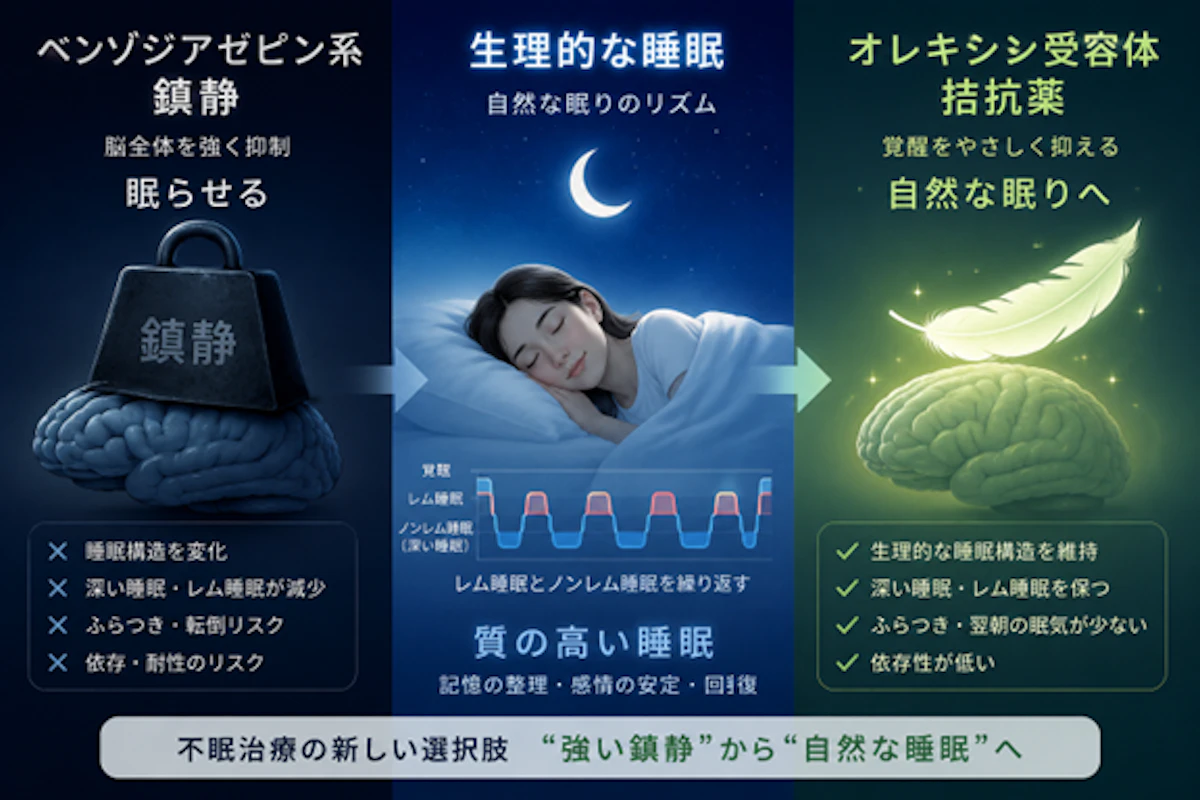 生理的な睡眠とベンゾジアゼピン系鎮静の違い ― オレキシン受容体拮抗薬の有用性