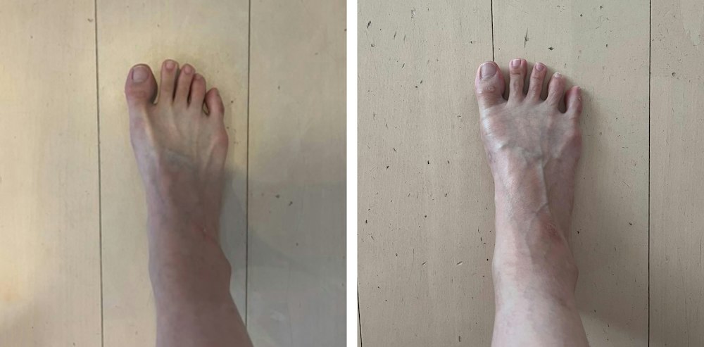 私の足裏、野生に還る?足裏を育てた3ヶ月のリアルドキュメント 〜ベアフットシューズ「歩歩 HOPPO」〜
