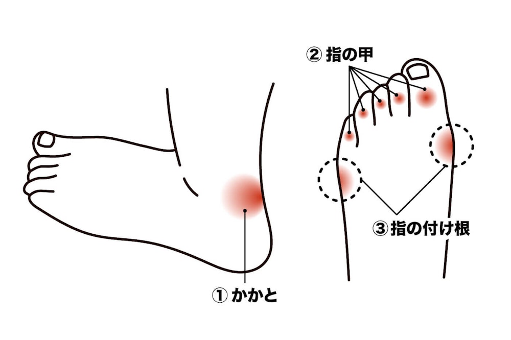 足の疲れにおすすめ｜３つのサポートアイテムで快適登山