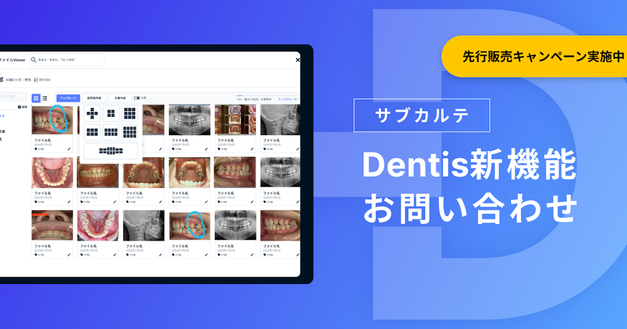 Dentis新機能に関するお問い合わせ