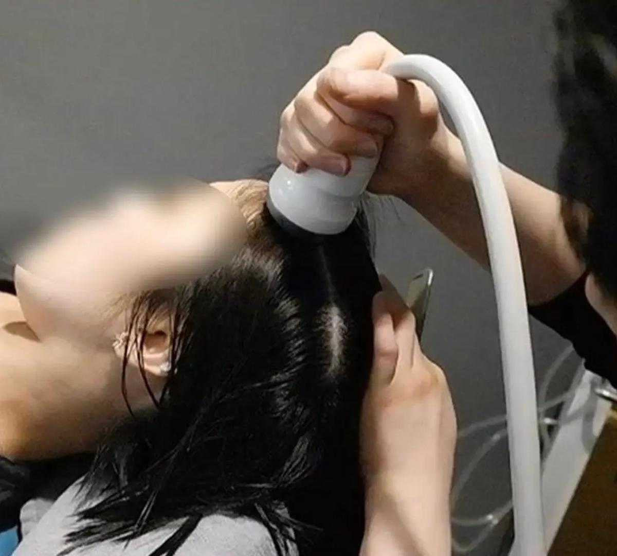 明洞で薄毛予防ケア後、髪にツヤが戻った頭皮ケア体験の仕上がり