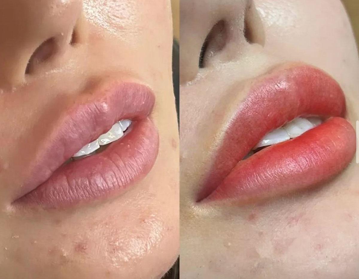 明洞アニスブロウのアートメイク施術風景