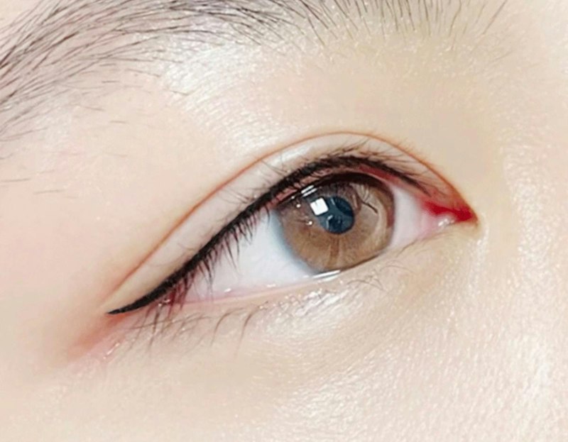 明洞アートメイク セカジソウォン医院の4D眉エンボ施術