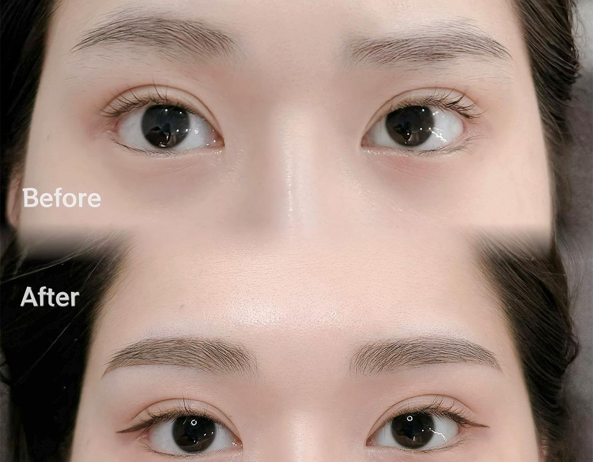 BROW DOLL 江南のコンボ眉毛アートメイク仕上がり