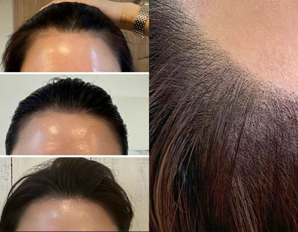 アニスブロウ 眉アートメイク 施術例