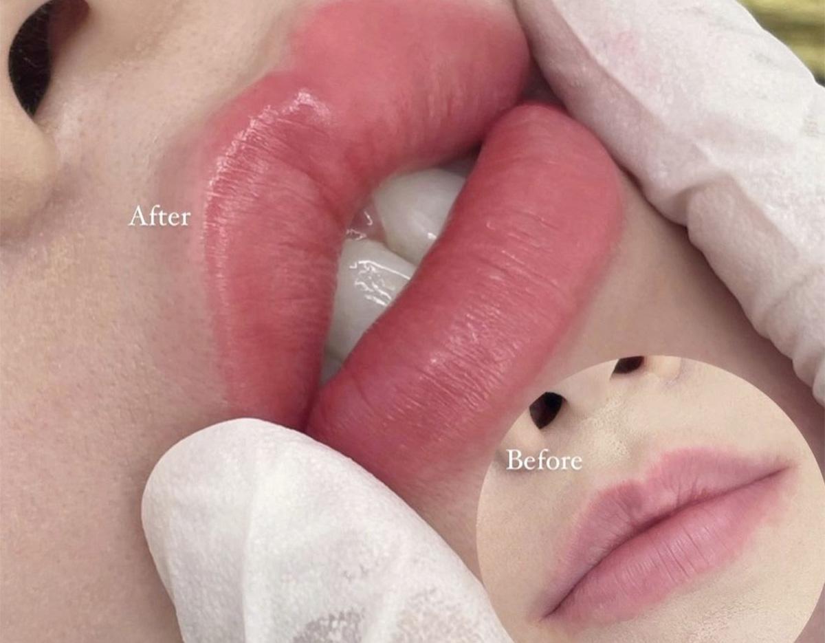 BROW DOLL 江南のヘアラインアートメイク施術例