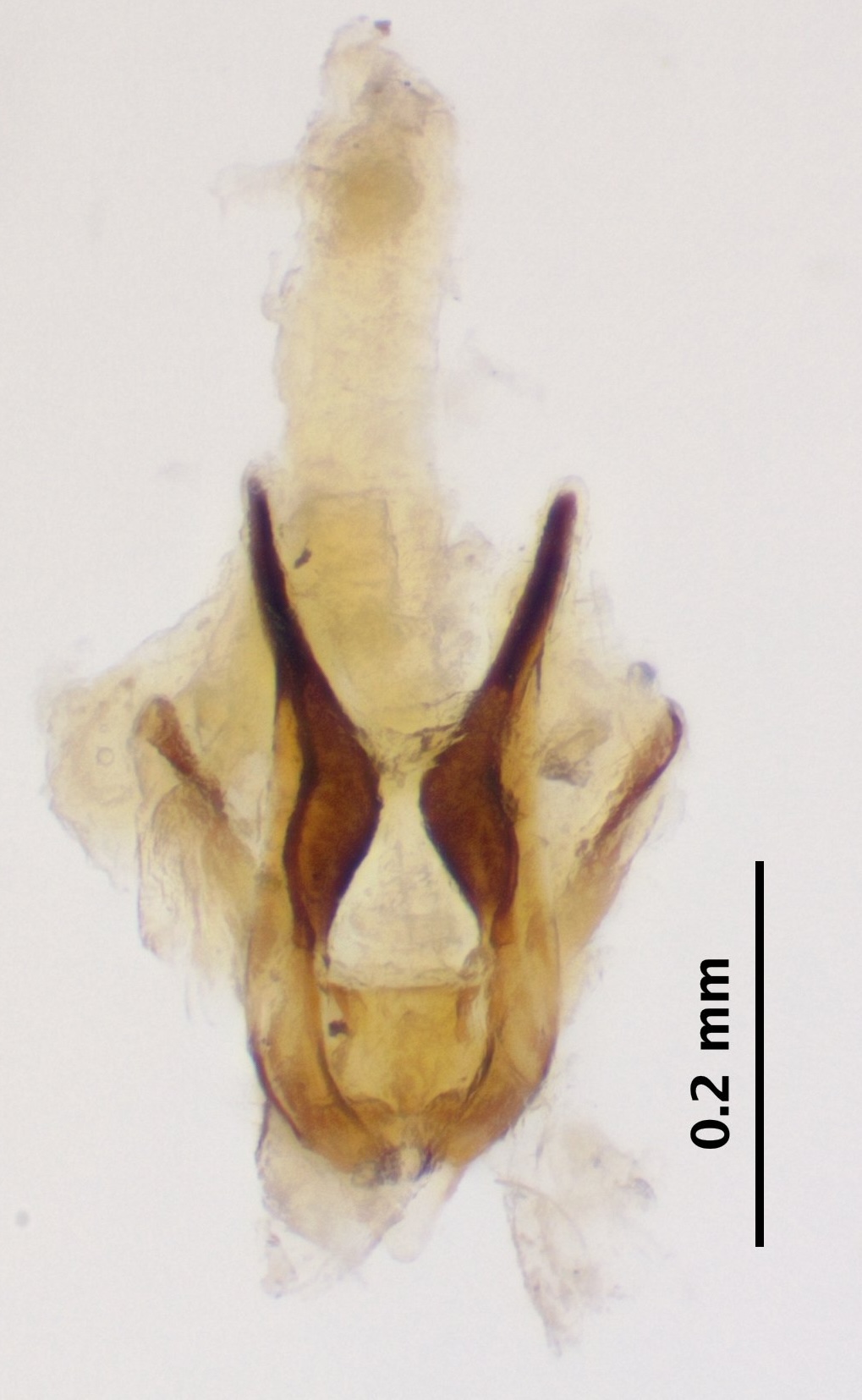 8_aedeagus_complex