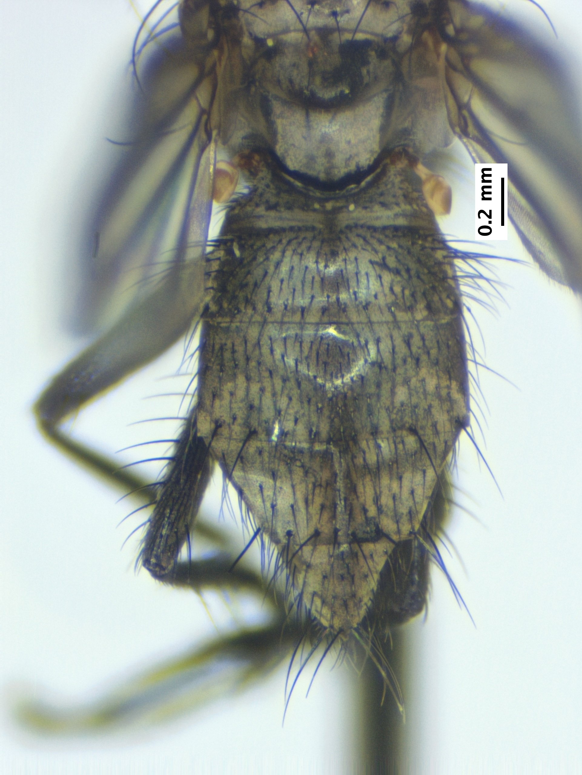 6_abdomen_dorsal