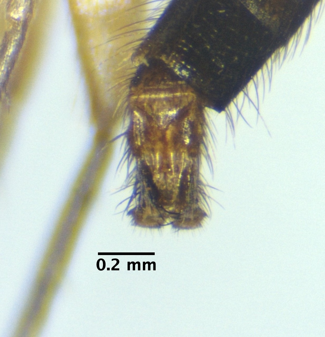 genitalia_ventral-dry