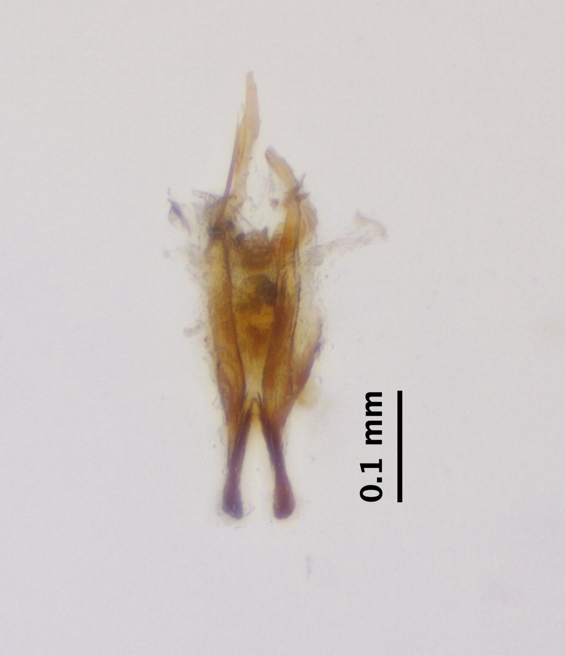 aedeagus_complex_dorsal