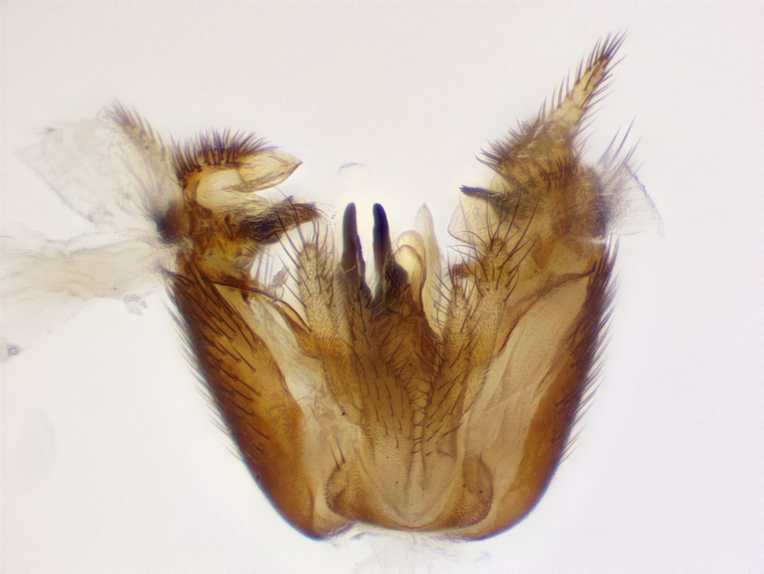 5_genitalia_dorsal
