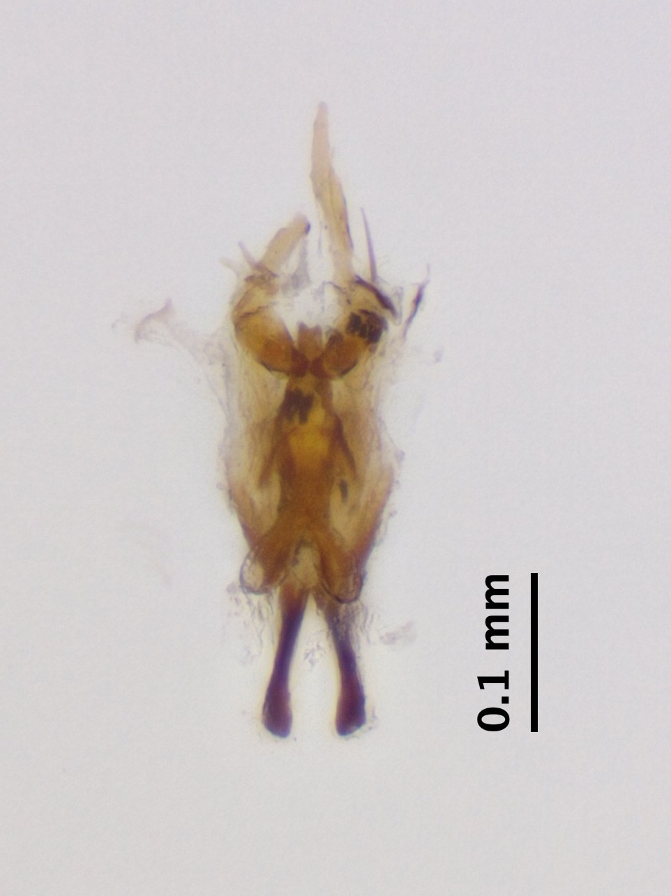 aedeagus_complex_ventral
