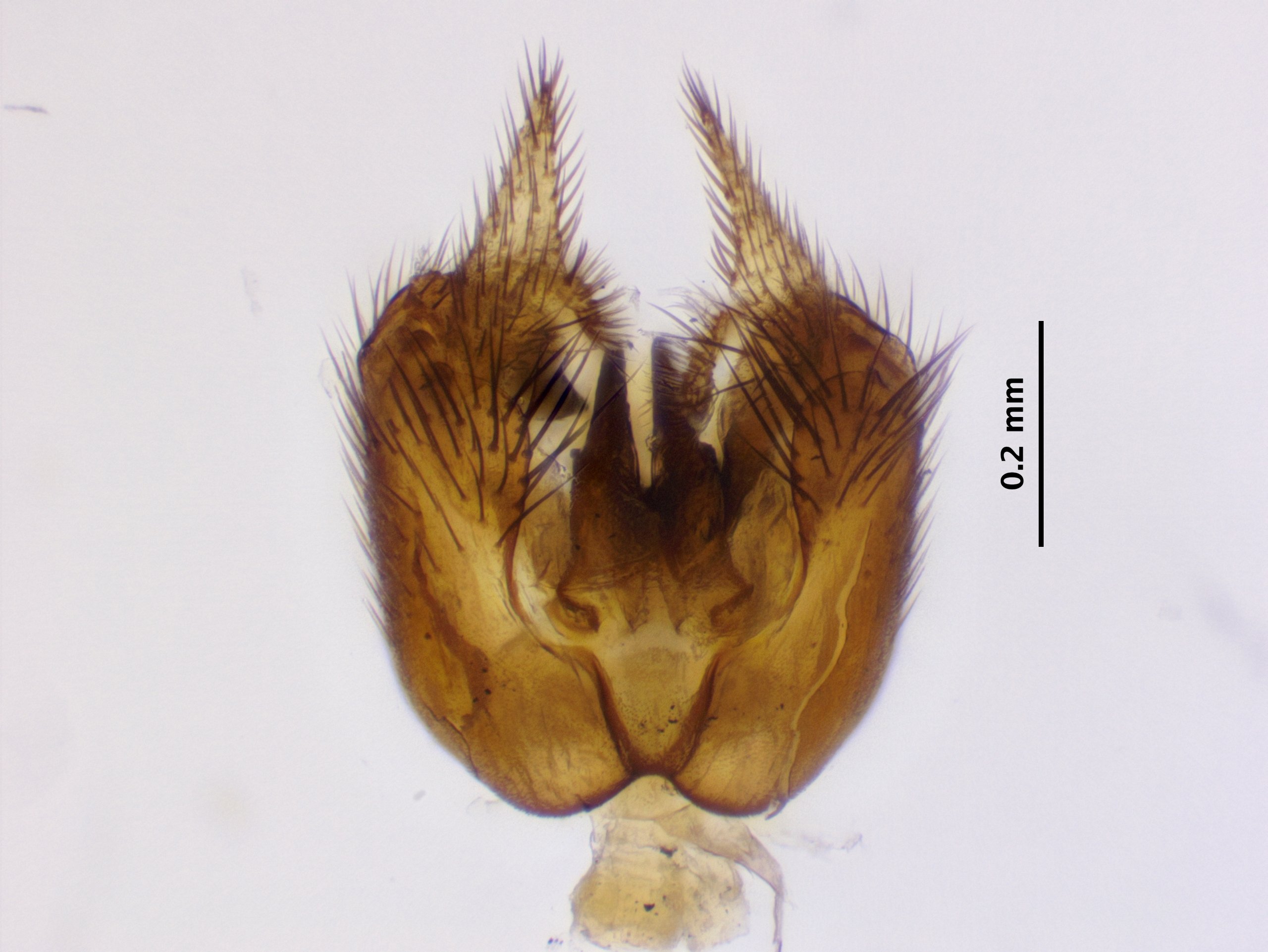7_genitalia_ventral