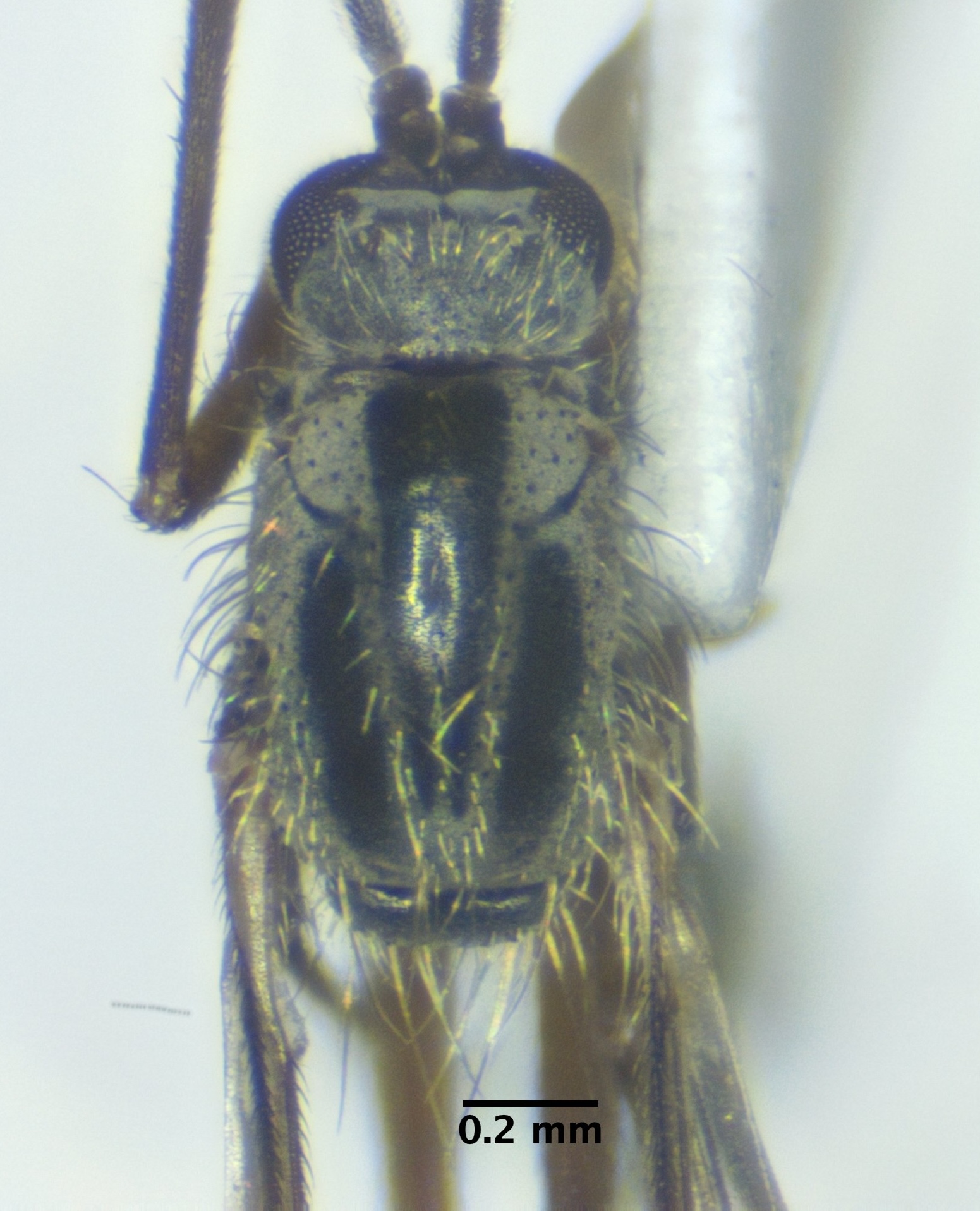 thorax_dorsal
