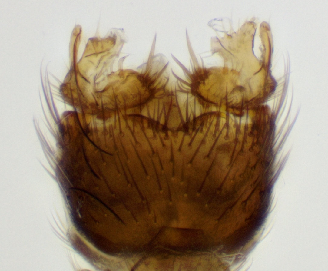 genitalia_ventral