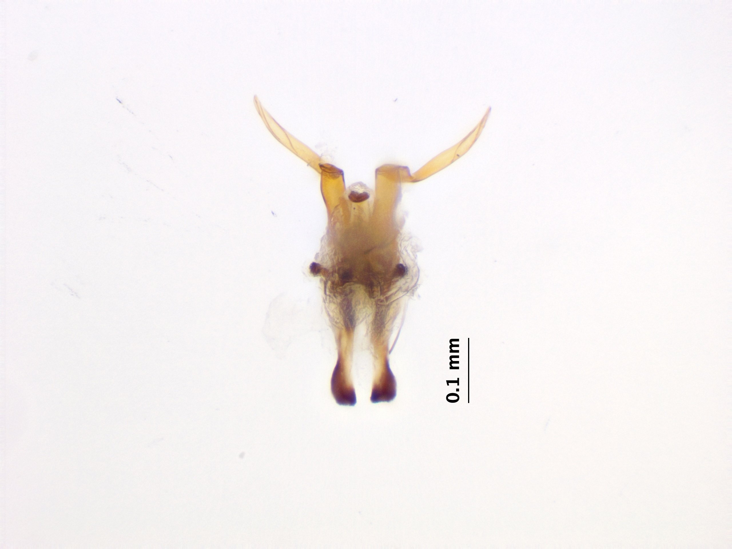 8_aedeagal_complex_1