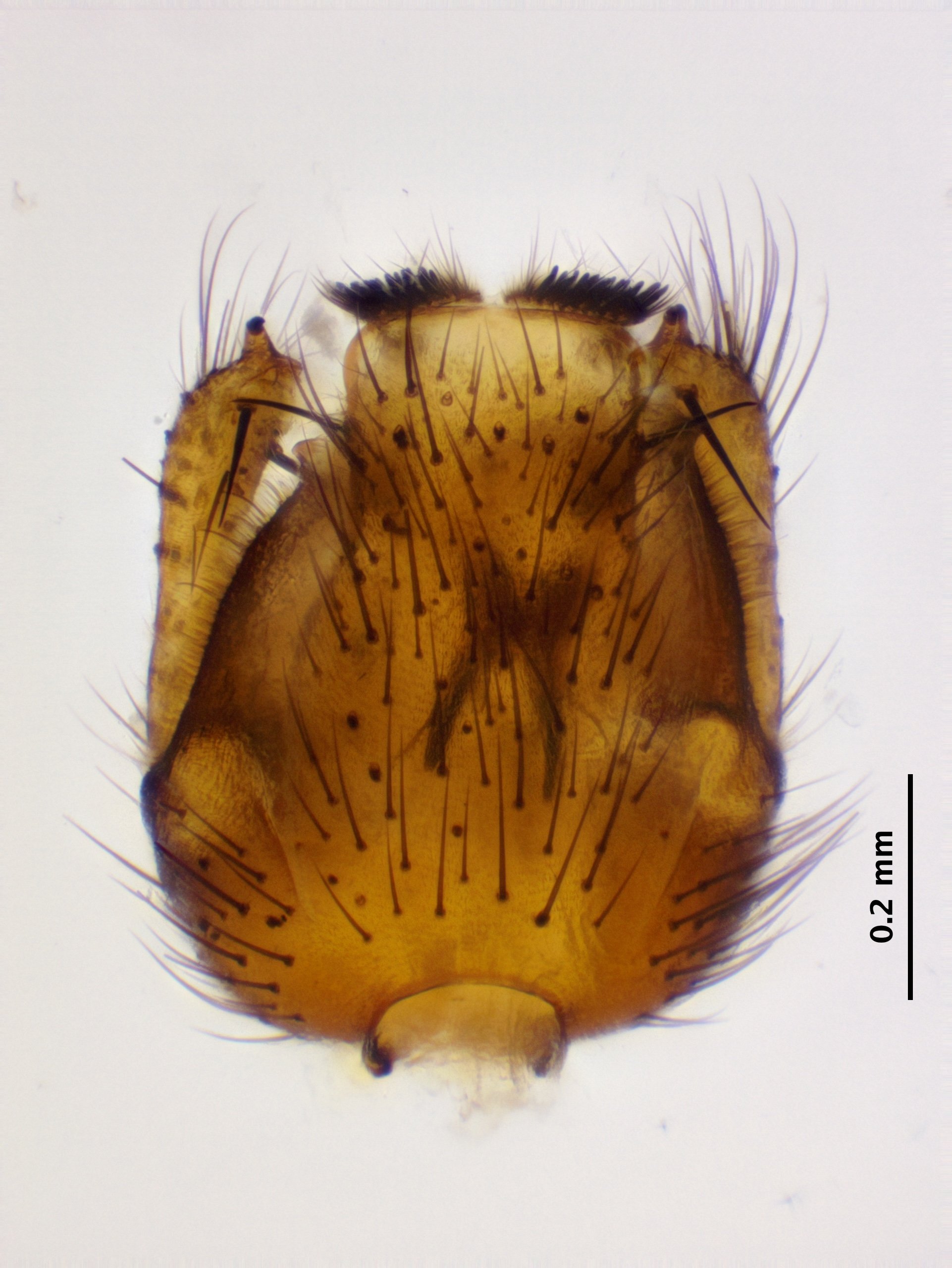 6_genitalia_dorsal