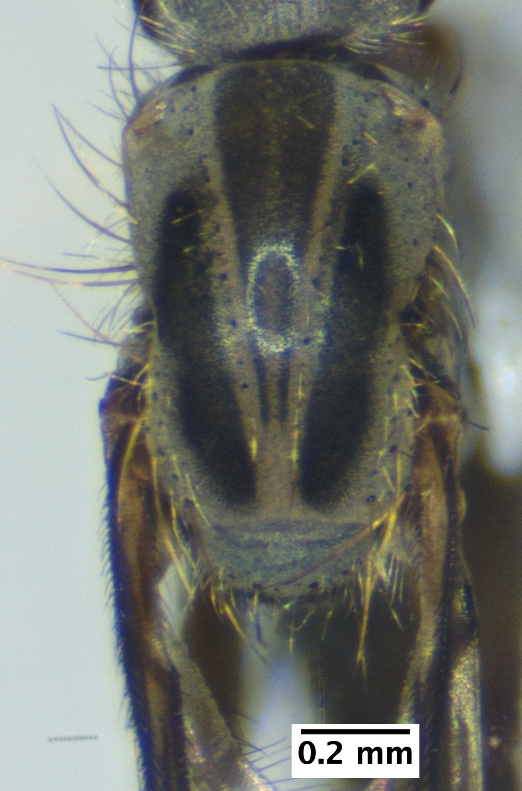 2_thorax_dorsal