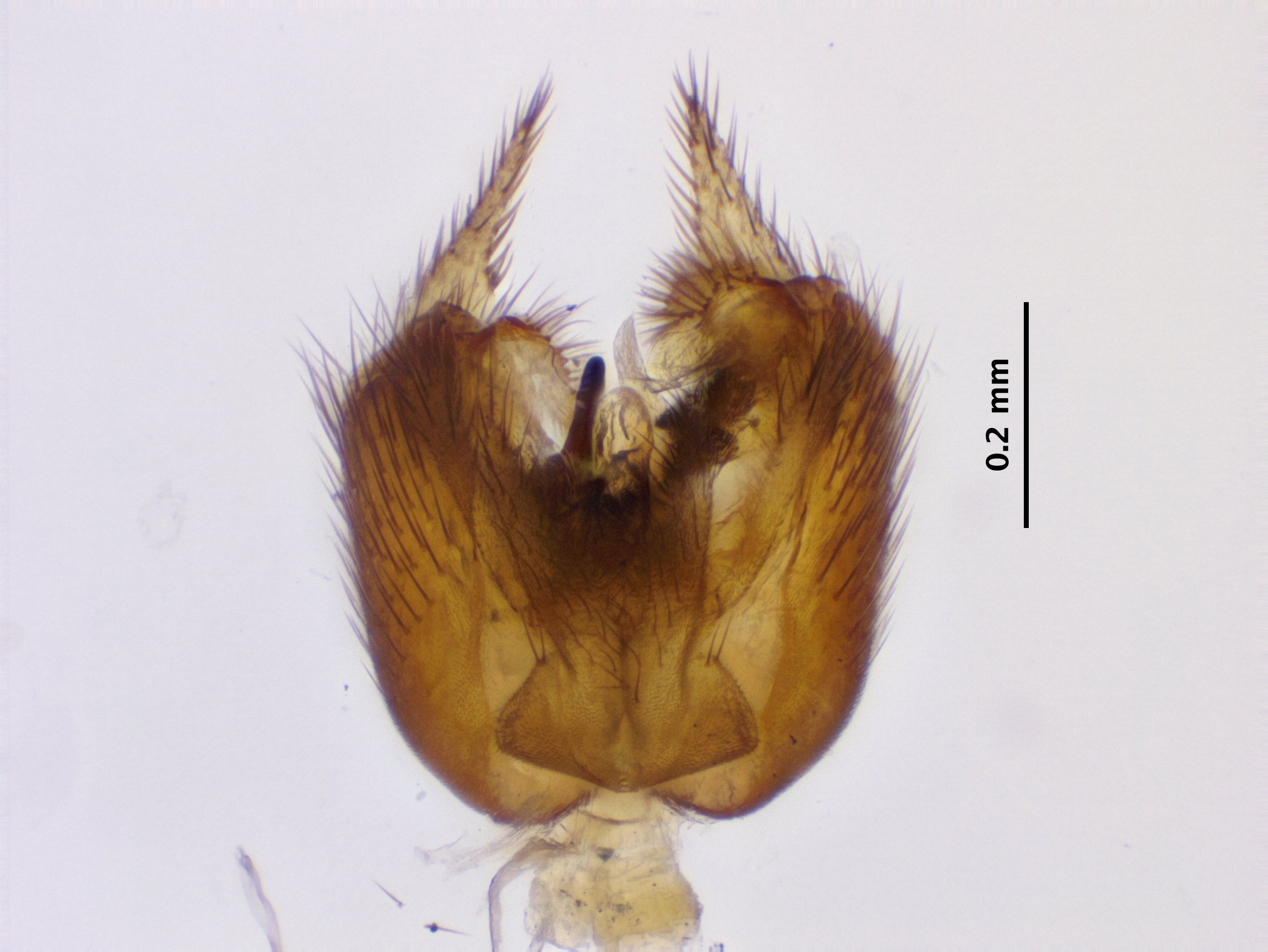 6_genitalia_dorsal