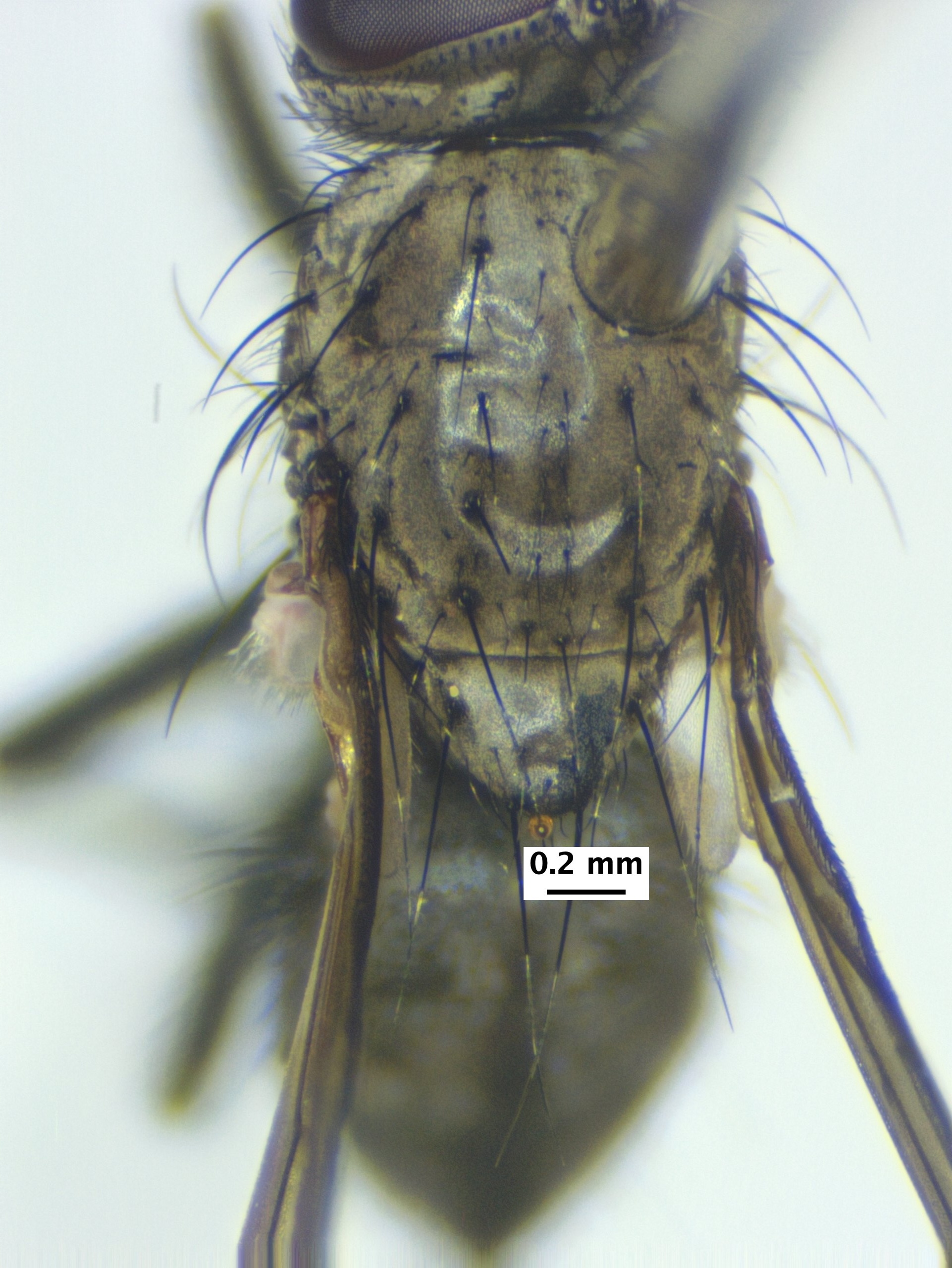 5_thorax_dorsal