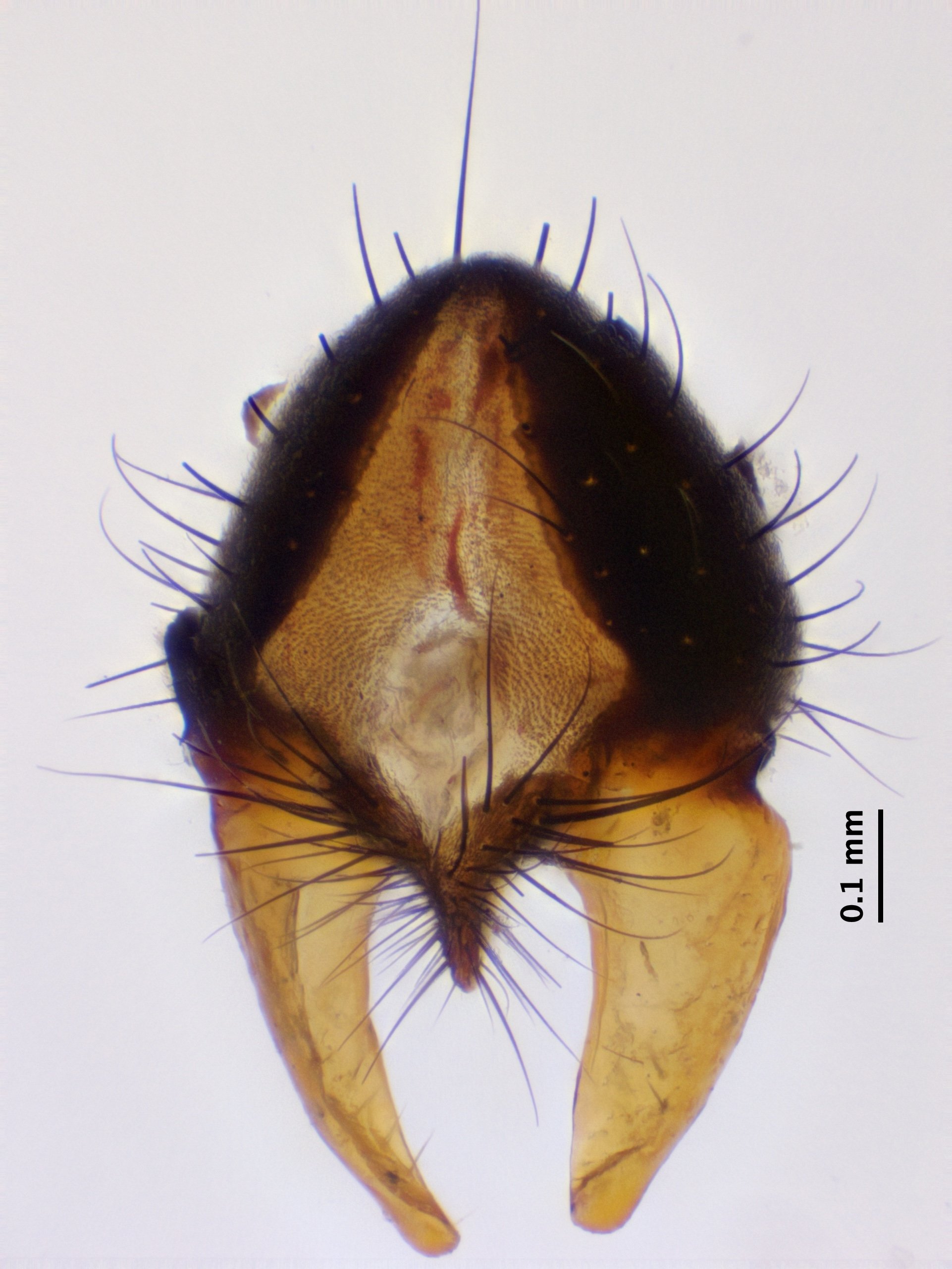 7_cercus-surstylus_dorsal