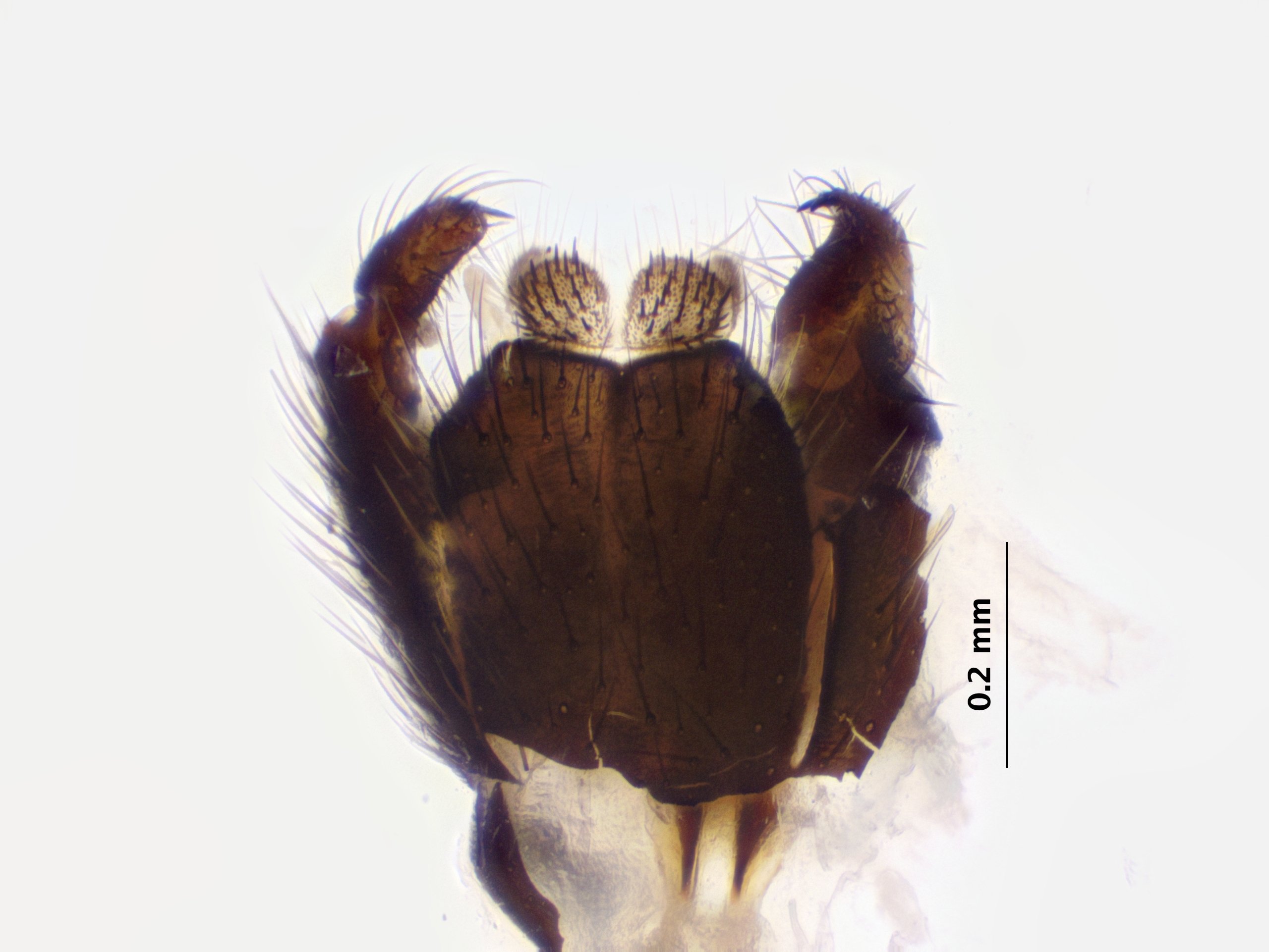 5_genitalia_dorsal