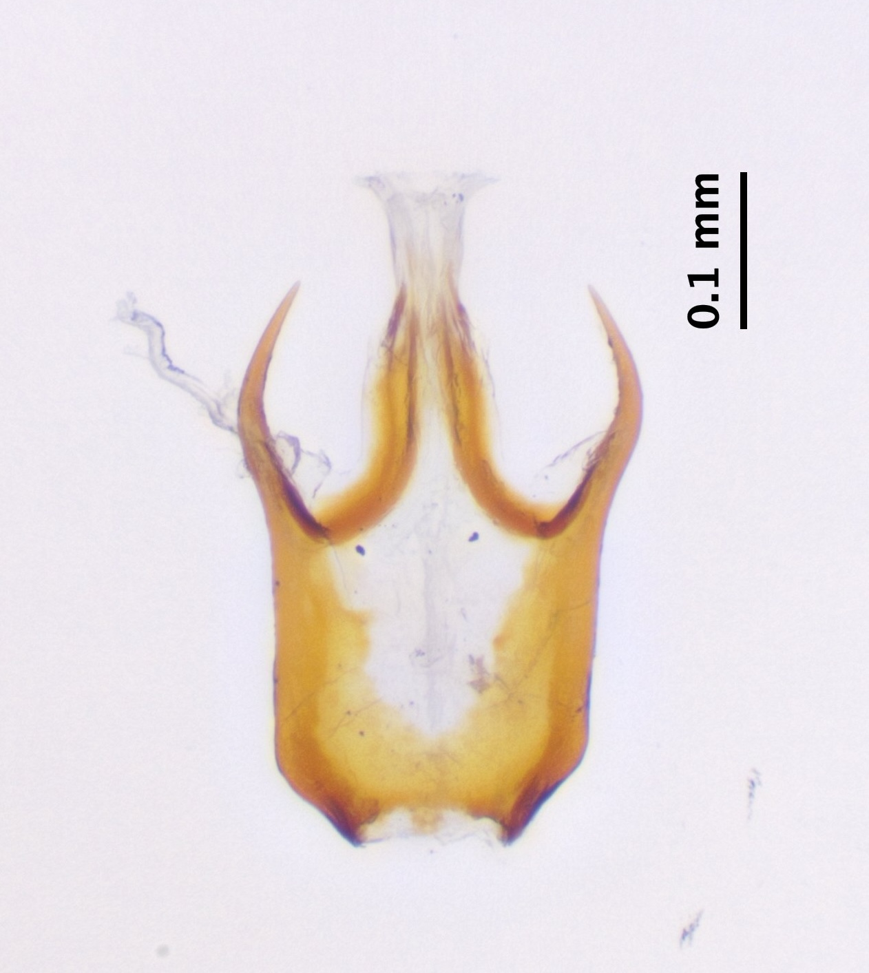 11_aedeagus_dorsal