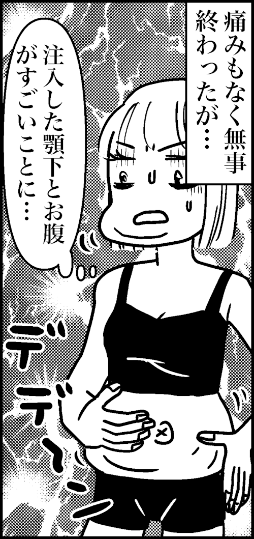 オバコン-25-5-6