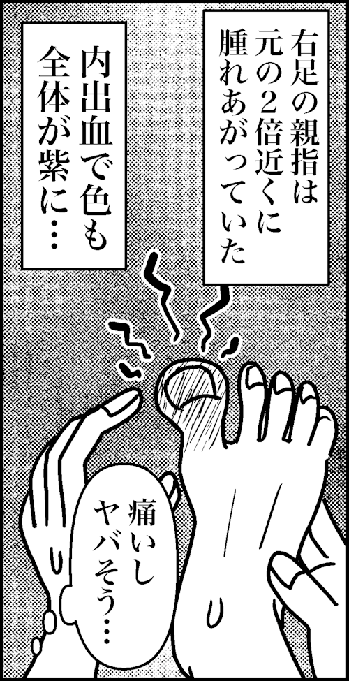 オバコン-21-3-1