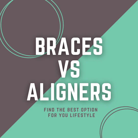 ワイヤー矯正とマウスピース矯正、どっちが合う?生活スタイル別の選び方【歯科医が解説】