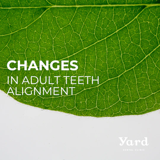 大人になってから気づく歯並びの変化について — Yard Dental Clinic