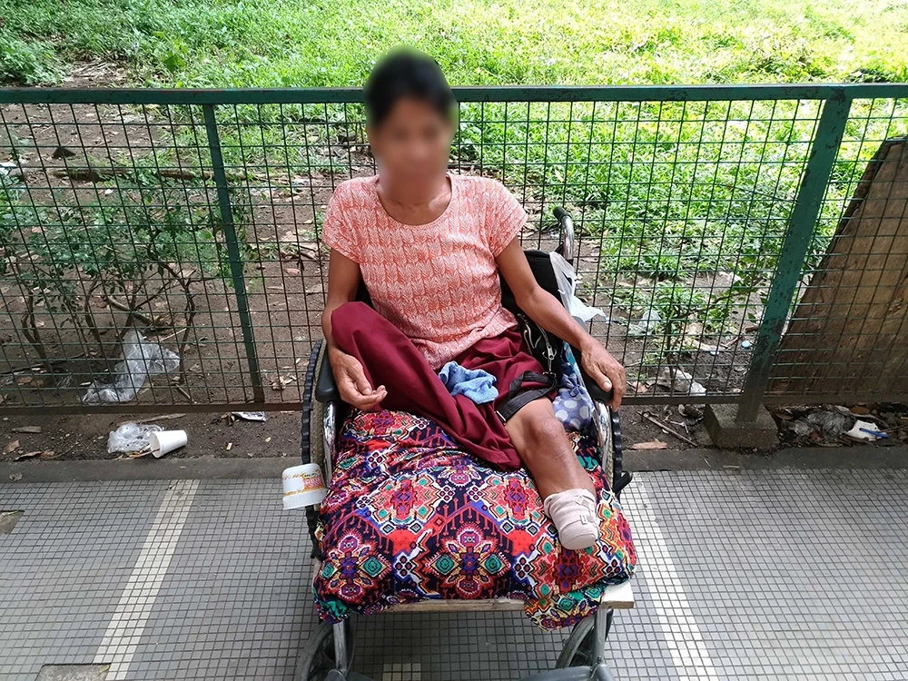 下肢切断者の写真