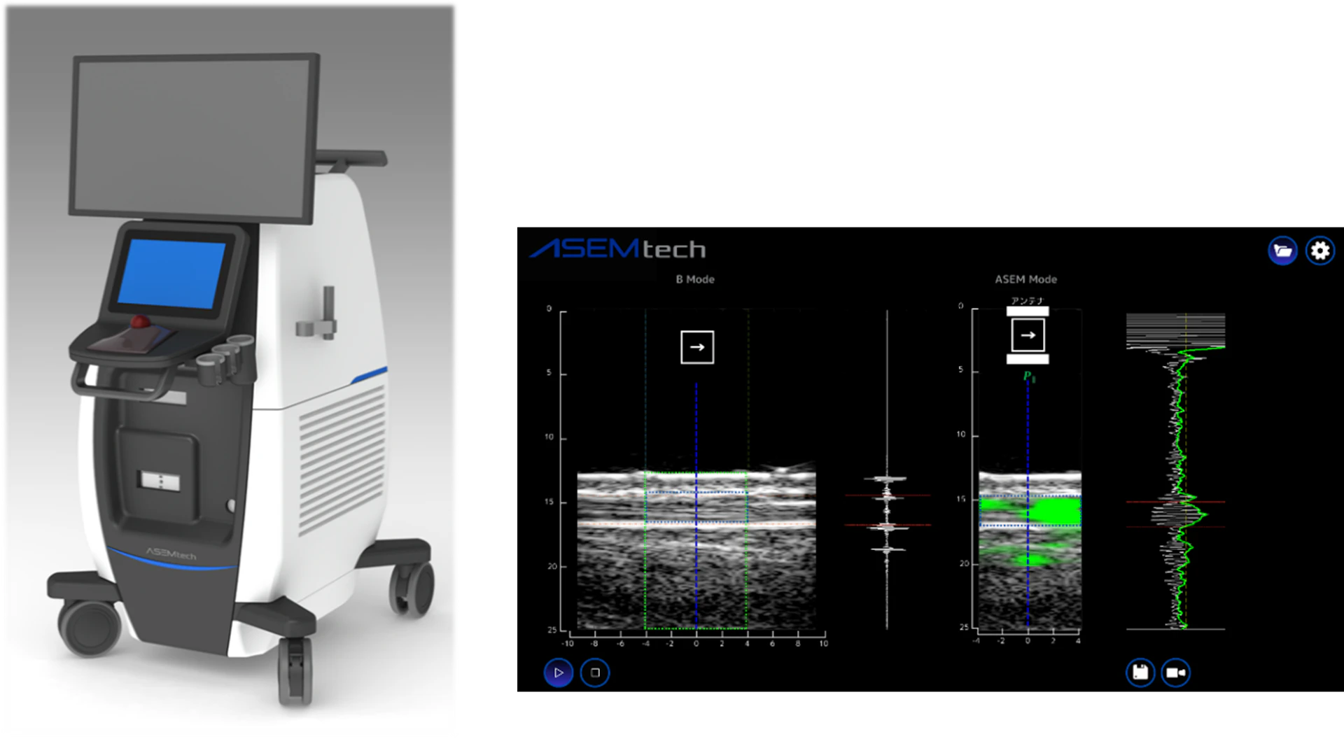 原子・分子レベルで“質”を可視化するセンシング技術──ASEMtechがシリーズAで2.5億円を調達、医療機器実用化へ本格始動