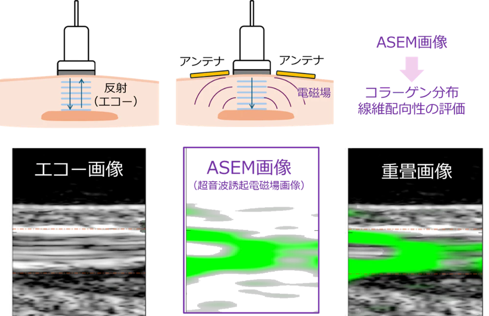 ASEM画像