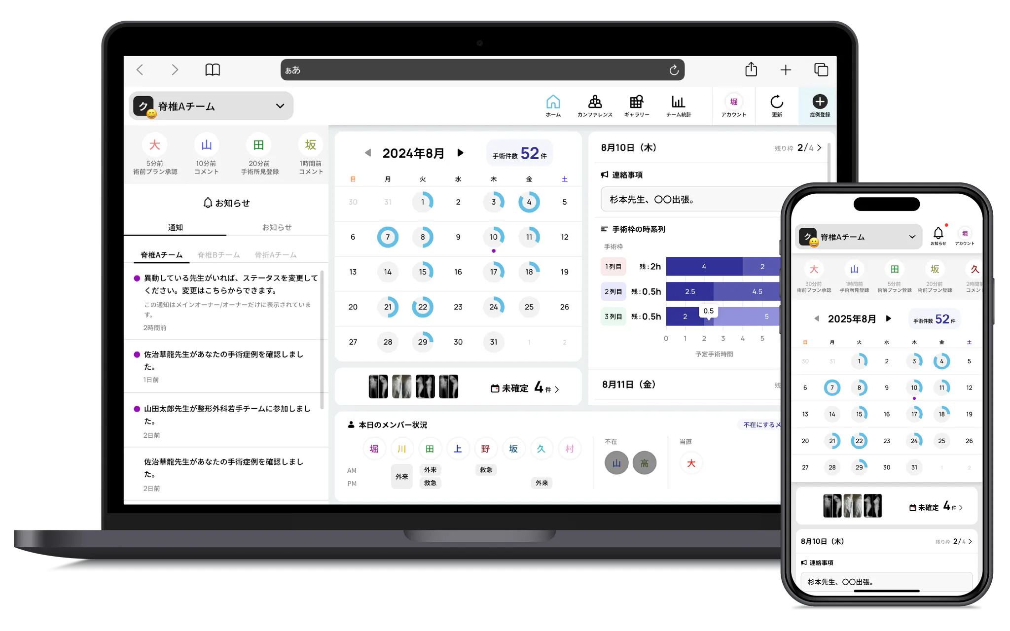 外科系チーム医療DXのクラウド型ツール「OpeOne」のUI