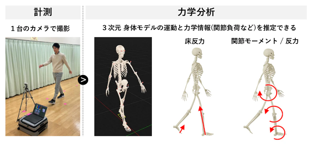 1台のカメラで、客観的・定量的に“痛みの原因”を特定
