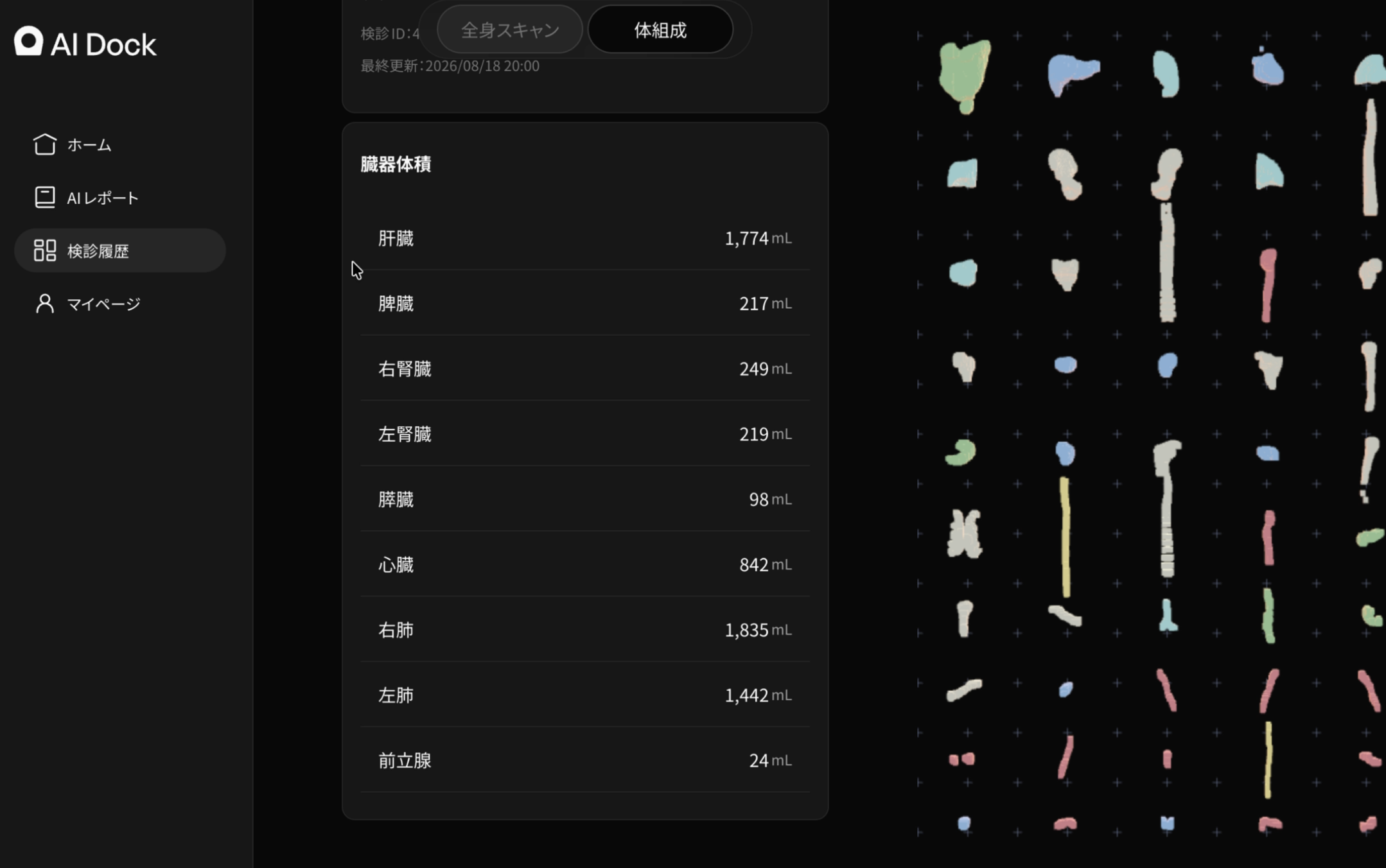 AI Dockでは、体組成だけでなく臓器の形も確認することができる。（画像：同社提供）