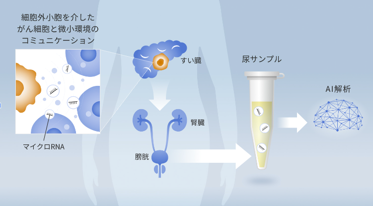 たった1回の採尿ですい臓がんを早期発見可能に！尿中マイクロRNA