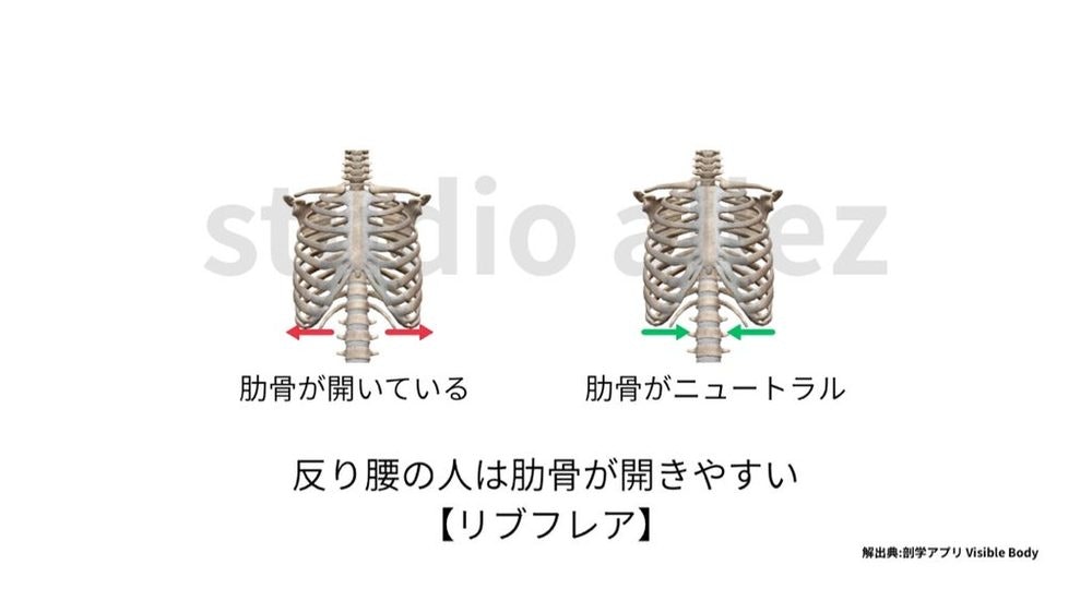 知らないと損する反り腰の基礎知識 | 原因・特徴・チェック法