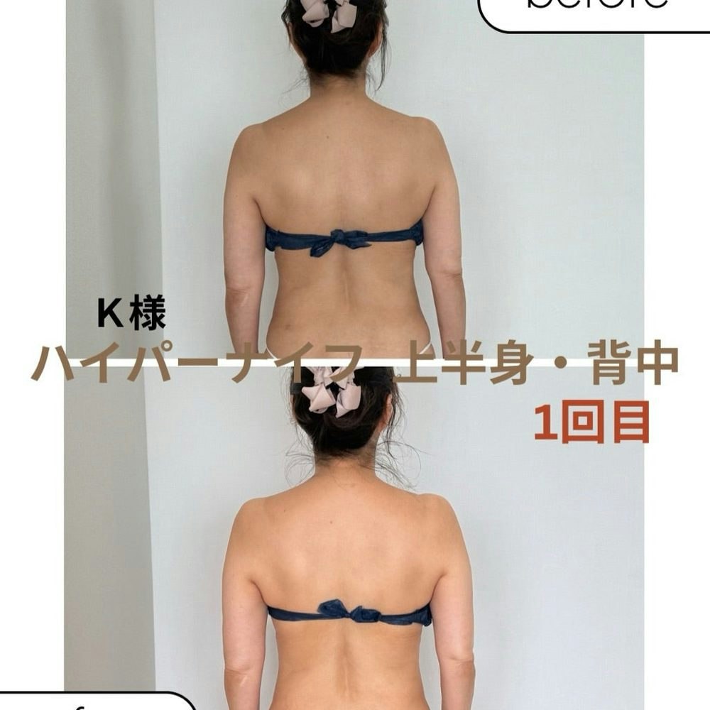 【続編】夏のカラダを整えるヒント | 〜脂肪ほぐし編〜