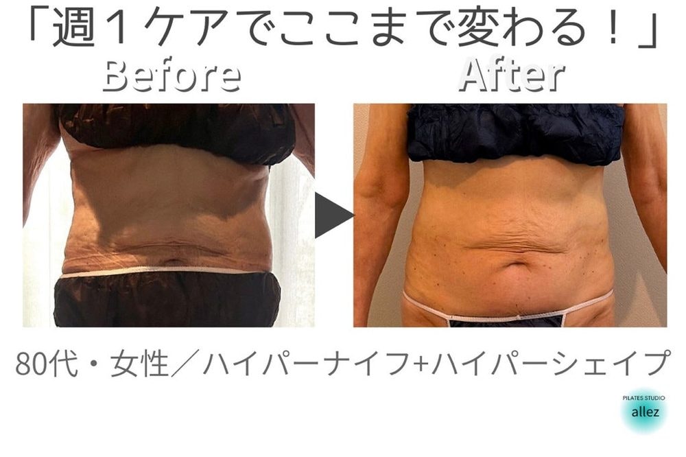 【週１ケアでここまで変わるの？】タルタルの皮膚がキュッと締まってきたお話